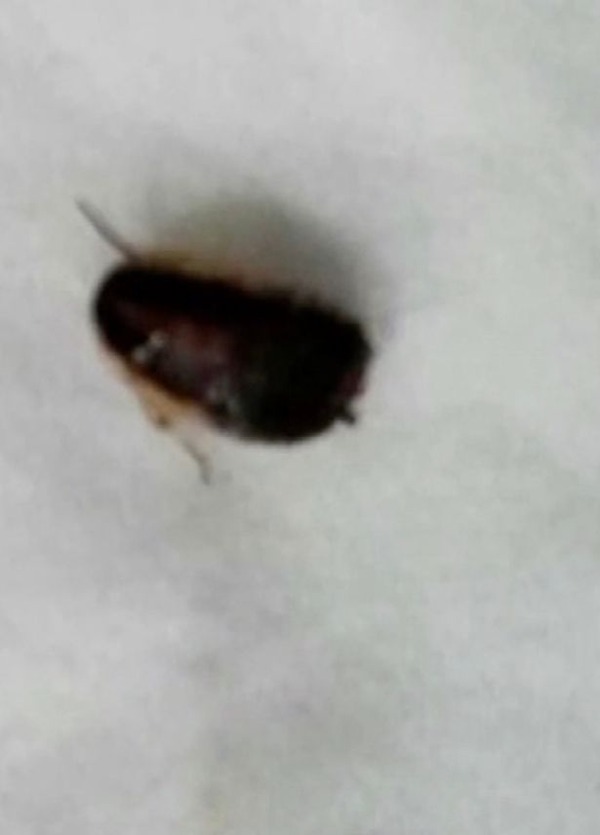 Gross-ANOTHER-cockroach-found-living-inside-mans-ear