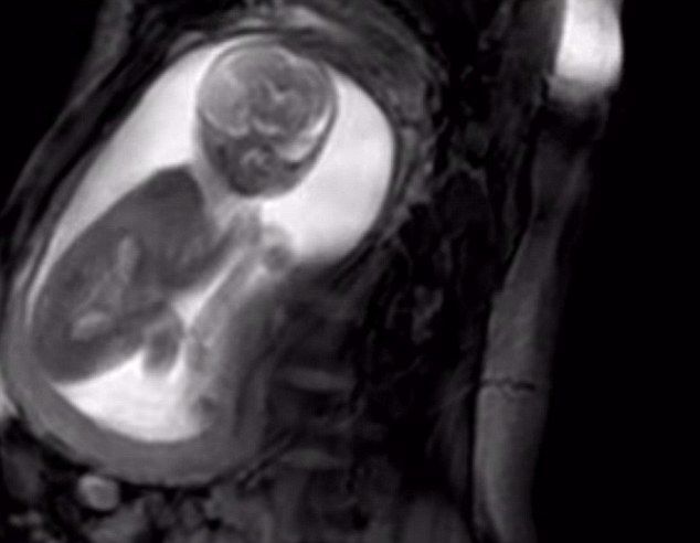 【ぎゃあああ】MRIでお腹の赤ちゃんを撮影した結果！→衝撃的映像に！ 秒刊SUNDAY