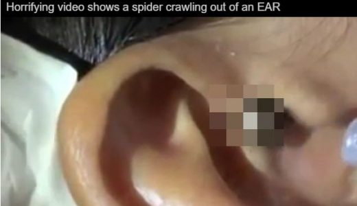 【閲覧注意】ギャア！耳からクモが這い出す不気味な映像が話題に