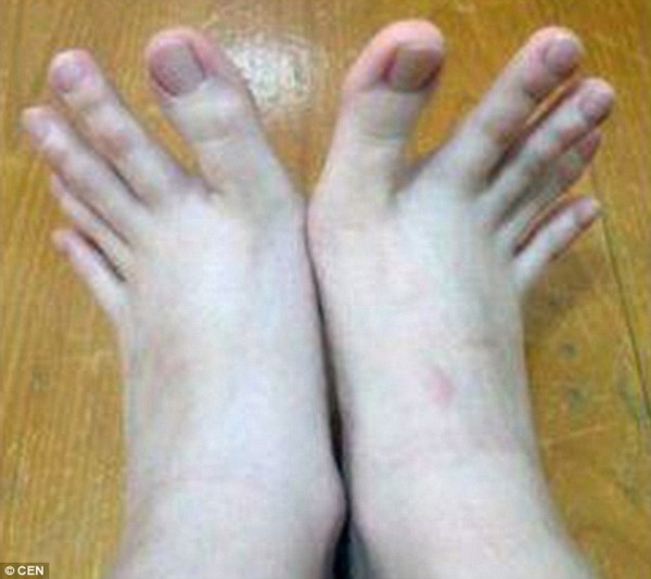 これマジ 足の指が 衝撃的な長さ の写真がアップされ話題に ホンモノか 秒刊sunday