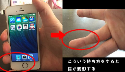【注意】スマホで指が変形する病気「テキストサム損傷」が多数報告されつつあることが判明！