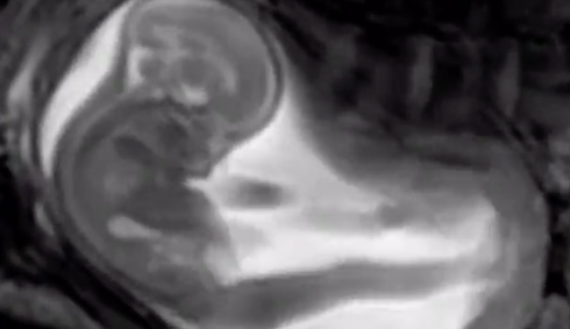 【ぎゃあああ】MRIでお腹の赤ちゃんを撮影した結果！→衝撃的映像に！